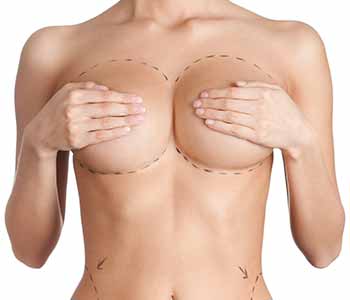 Why might Manhattan area patients consider breast reconstruction?
