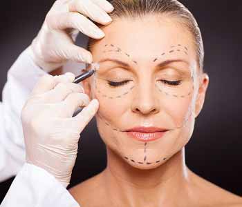 facelift in the Manhattan area By Dr. Edmund Kwan