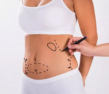 tummy tuck surgery from Dr. Edmund Kwan in nyc